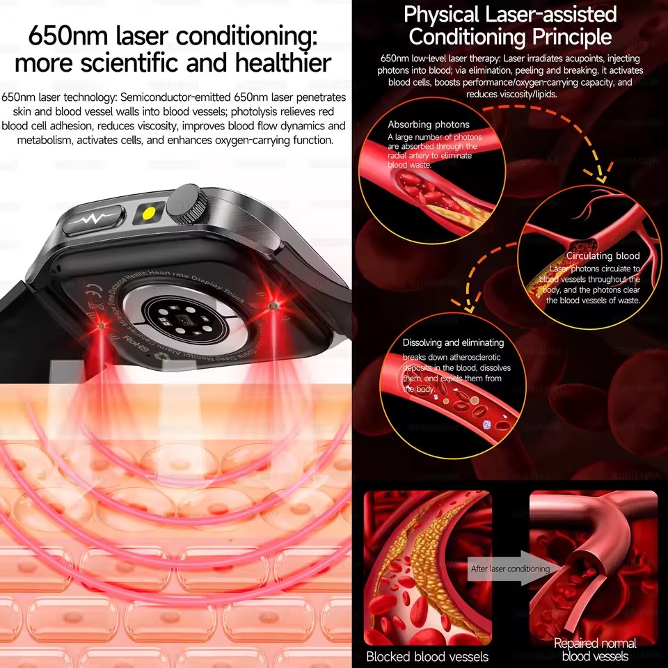 2026년 신형 헬스 스마트워치 레이저 치료로 고혈압, - Industrial Laser Temperature Sensor 리뷰 및 가격